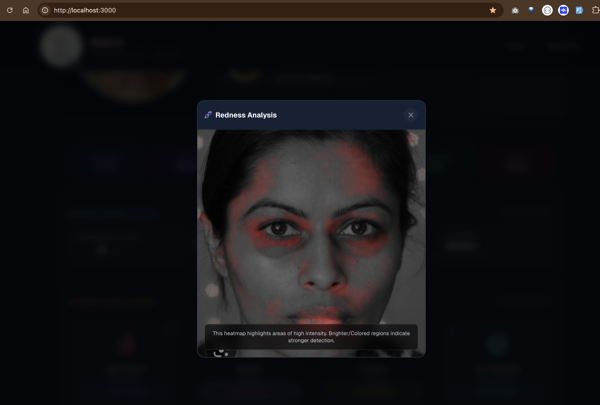 Redness Detection
